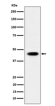 AdSS 2 Rabbit mAb [KD Validated]