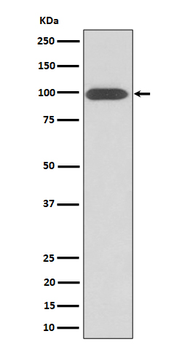 Integrin beta 3 / CD61 Rabbit mAb Antibody