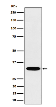 TSFM Rabbit mAb [KD Validated]