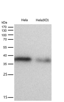 C3orf38 Rabbit mAb [KD Validated]