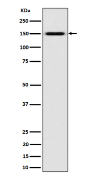 SLC12A1 / NKCC2 Rabbit mAb Antibody