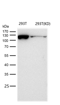 KIF5B Rabbit mAb [KD Validated]