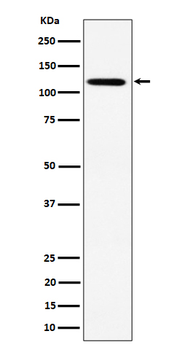 KIF5B Rabbit mAb [KD Validated]