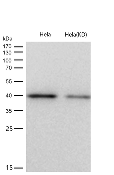 ACADS / SCAD Rabbit mAb [KD Validated] Antibody