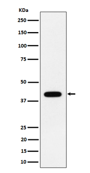 ACADS / SCAD Rabbit mAb [KD Validated] Antibody