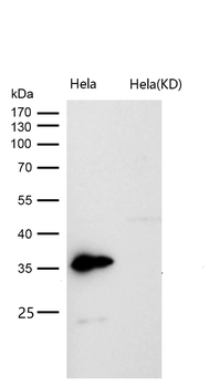OXGR1 / GPR99 Rabbit mAb [KD Validated] Antibody