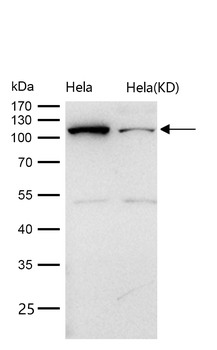 SPINK5 / LEKTI Rabbit mAb [KD Validated] Antibody