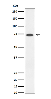 SSTR3 Rabbit mAb Antibody