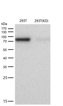 CTP synthase / CTPS Rabbit mAb [KD Validated] Antibody