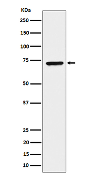 CTP synthase / CTPS Rabbit mAb [KD Validated] Antibody