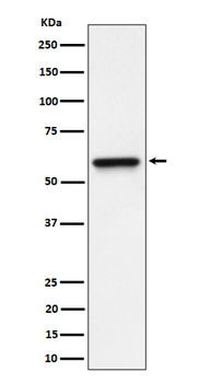 RGS6 Rabbit mAb Antibody