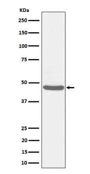 BCKDK Rabbit Monoclonal Antibody