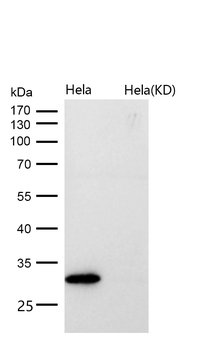 MTAP Rabbit mAb [KD Validated]