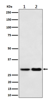 MTAP Rabbit mAb [KD Validated]