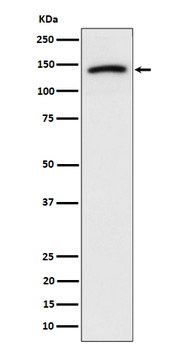 Cadherin 10 Rabbit mAb Antibody