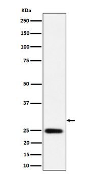 NAT1 Rabbit mAb Antibody