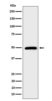 AMSH Rabbit mAb Antibody