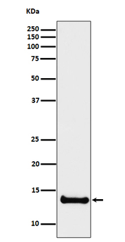 Cystatin B Rabbit mAb Antibody