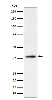 FDPS Rabbit mAb [KD Validated] Antibody