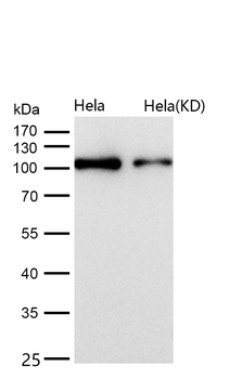 ZHX2 Rabbit mAb [KD Validated]