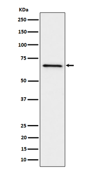 GRK6 Rabbit mAb Antibody