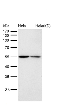 p60 katanin Rabbit mAb [KD Validated] Antibody