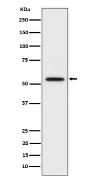 p60 katanin Rabbit mAb [KD Validated] Antibody