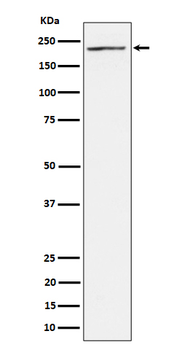 MAP3K4 Rabbit mAb Antibody