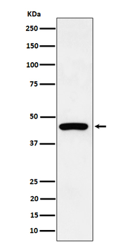 Cytokeratin 19 Rabbit mAb Antibody
