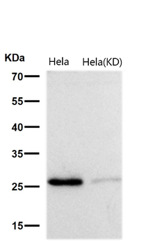 GCLM Rabbit mAb Antibody