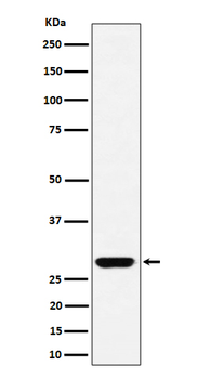 GCLM Rabbit mAb Antibody