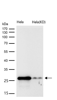 Galectin 3 Rabbit mAb [KD Validated]