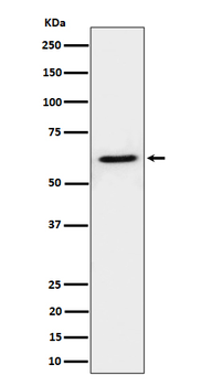IKZF3 Rabbit mAb Antibody