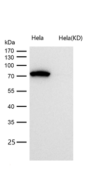 MMUT Rabbit mAb [KD Validated] Antibody