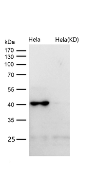 Spermine synthase Rabbit mAb [KD Validated] Antibody