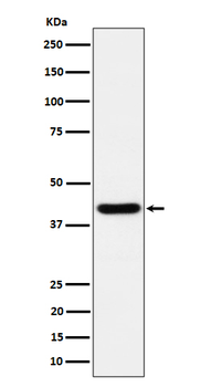Spermine synthase Rabbit mAb [KD Validated] Antibody