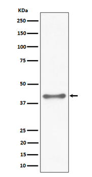 TTF1 Rabbit mAb Antibody