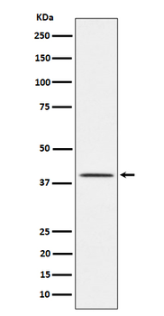 TTF1 Rabbit mAb Antibody