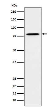 MUTA Rabbit mAb [KD Validated]