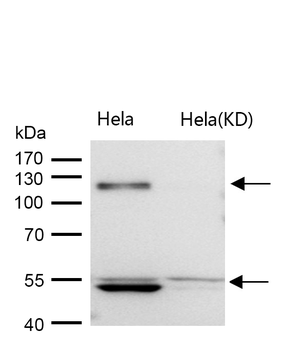 ORP1 Rabbit mAb [KD Validated] Antibody