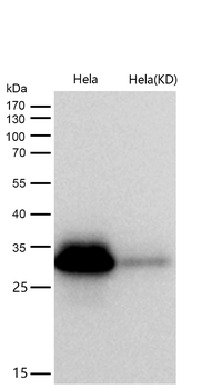 C1QBP Rabbit mAb [KD Validated]