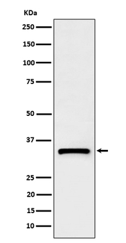 C1QBP Rabbit mAb [KD Validated]