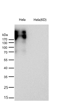 Fibronectin Rabbit mAb [KD Validated]