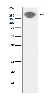 Fibronectin Rabbit mAb [KD Validated]
