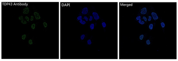 TDP43 Rabbit mAb [KD Validated]