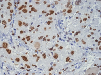TDP43 Rabbit mAb [KD Validated]