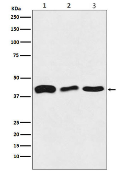 TDP43 Rabbit mAb [KD Validated]