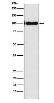 Desmocollin?3 Rabbit mAb