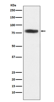 CARS Rabbit mAb Antibody