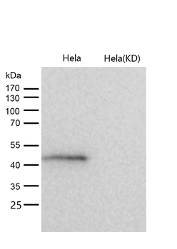 ADK Rabbit mAb [KD Validated] Antibody